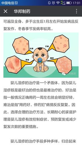 孩子湿疹怎么治疗