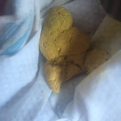 孩子两天不大便怎么办