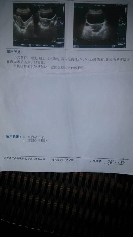 怀孕怎么查孩子是谁的
