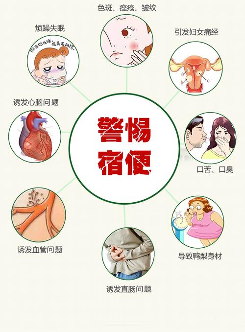 排宿便最有效的方法 运动