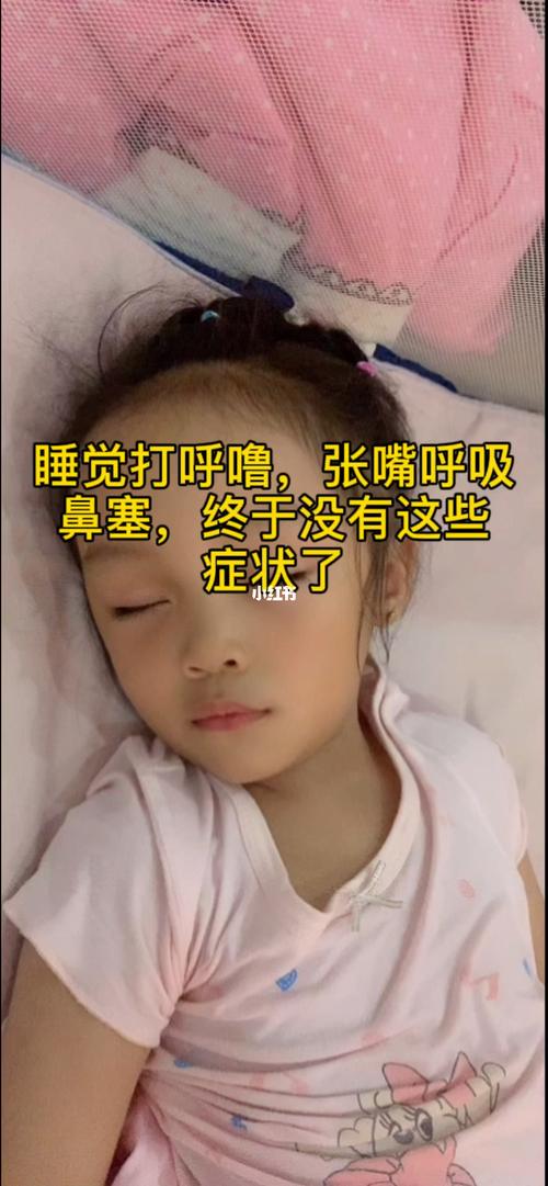 孩子腺样体肥大怎么治疗