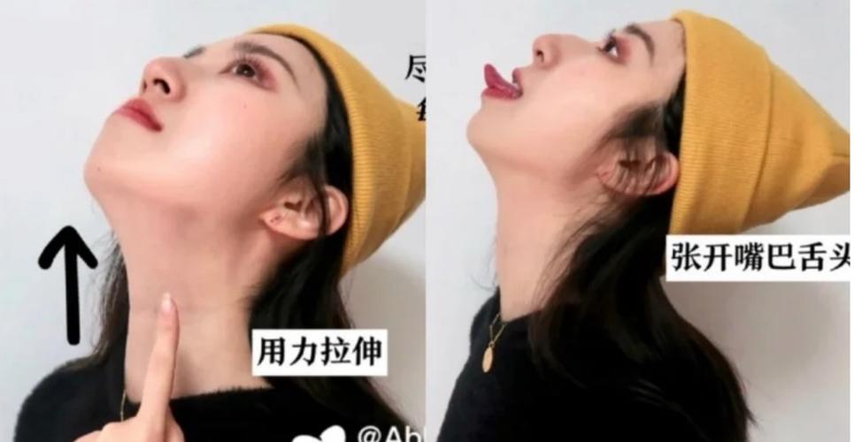 瘦下巴运动