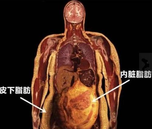 运动降内脏脂肪