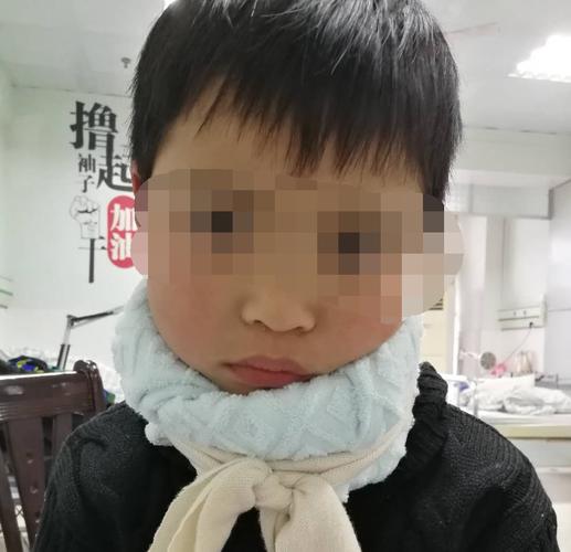 小孩子脖子扭了怎么办
