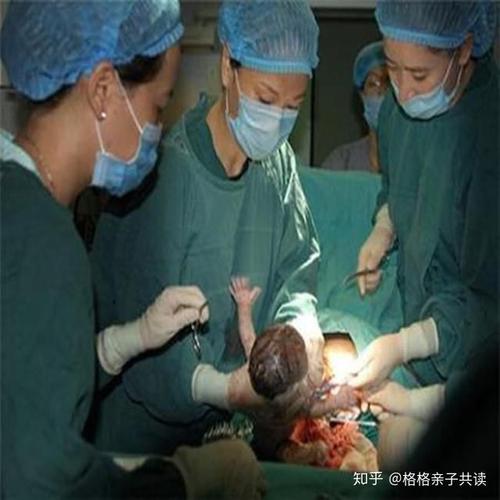 女生怎么生孩子
