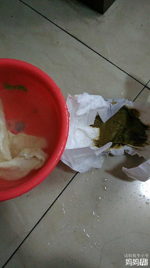 孩子几天不拉屎怎么办