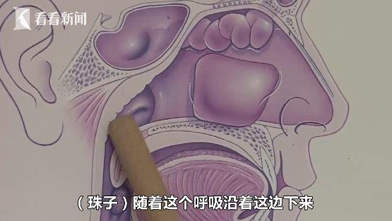 鼻子里卡了东西