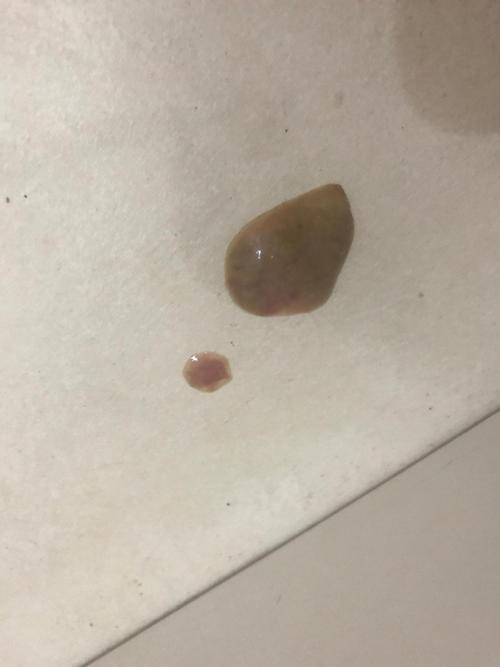 小猫不爱吃东西拉稀怎么办