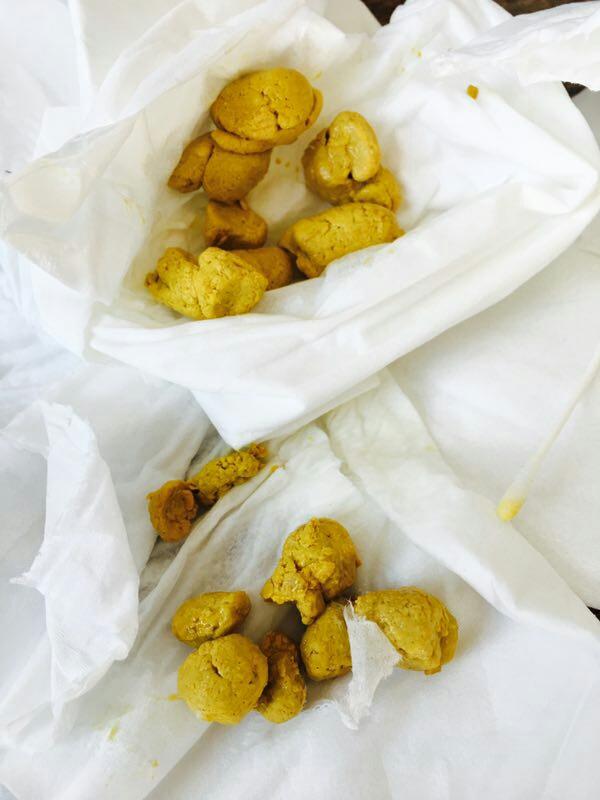 孩子拉不出来屎怎么办