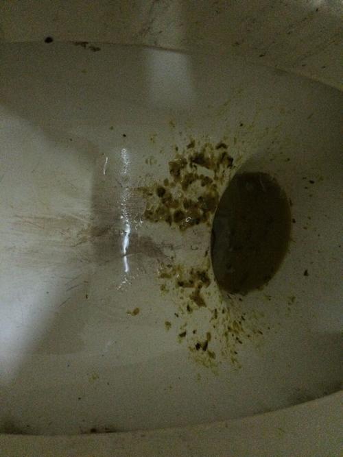 没吃东西拉稀怎么办