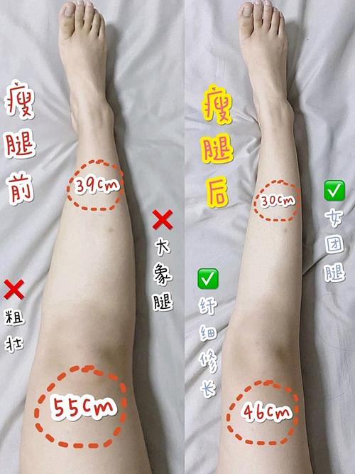 什么种类运动瘦腿