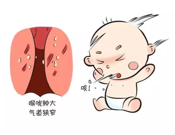 孩子咳嗽喘怎么办