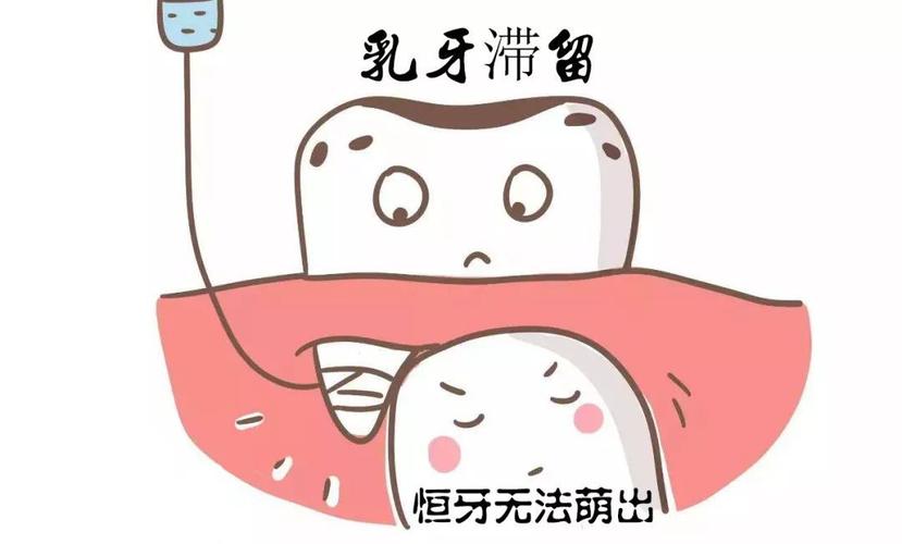 孩子口齿不清怎么办