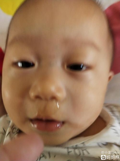 小孩子老是流鼻涕怎么办