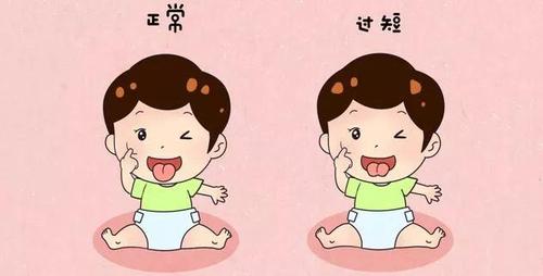 孩子发音不标准怎么办