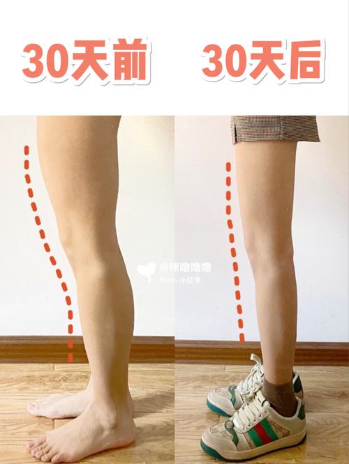 大量运动 腿粗