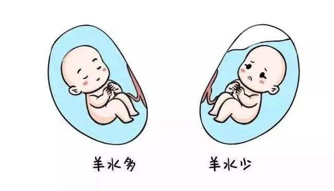 孩子羊水少怎么办