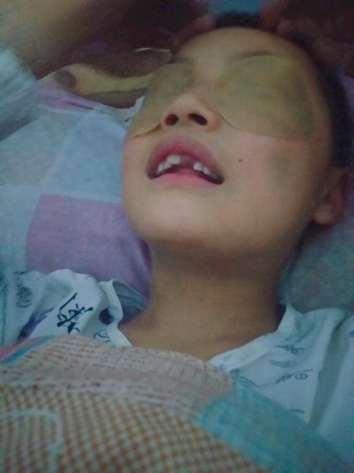 孩子脸磕青了怎么办