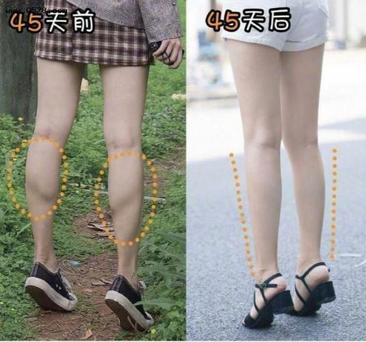 不停运动腿却没瘦怎么回事