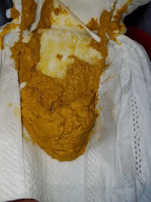 小孩子拉不出来屎怎么办