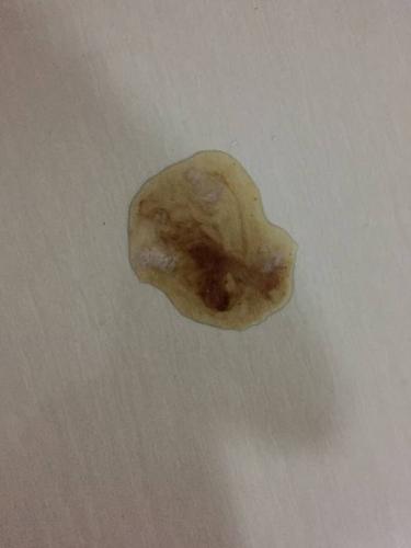 狗狗呕吐黏黏的东西怎么办
