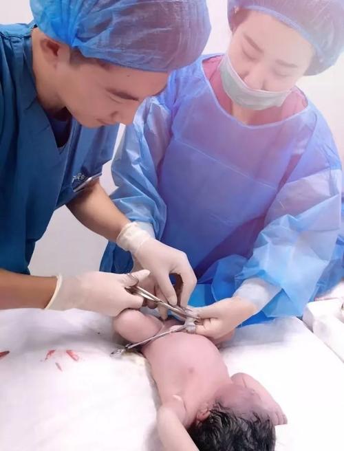 生完孩子脐带怎么处理