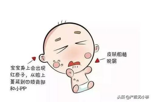 孩子脸皴了怎么办