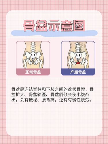 骨盆运动图解
