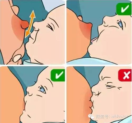 孩子不吸母乳怎么办