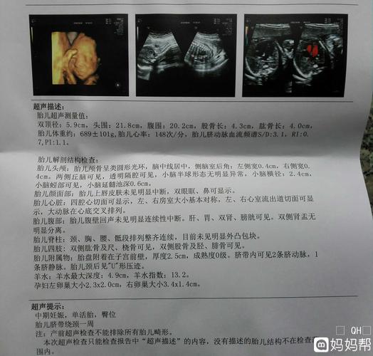 大排畸孩子不配合怎么办