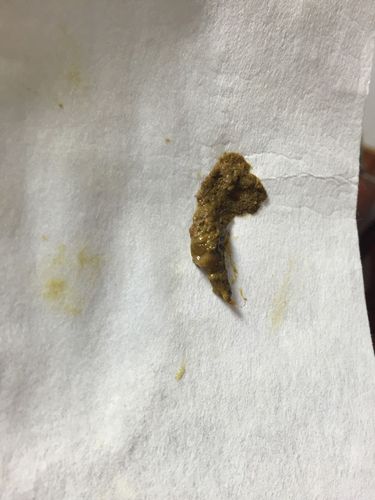 成年狗狗球虫拉血不吃东西怎么办