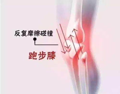 运动完膝盖疼怎么办