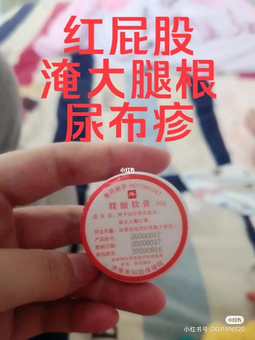 孩子大腿根淹了怎么办