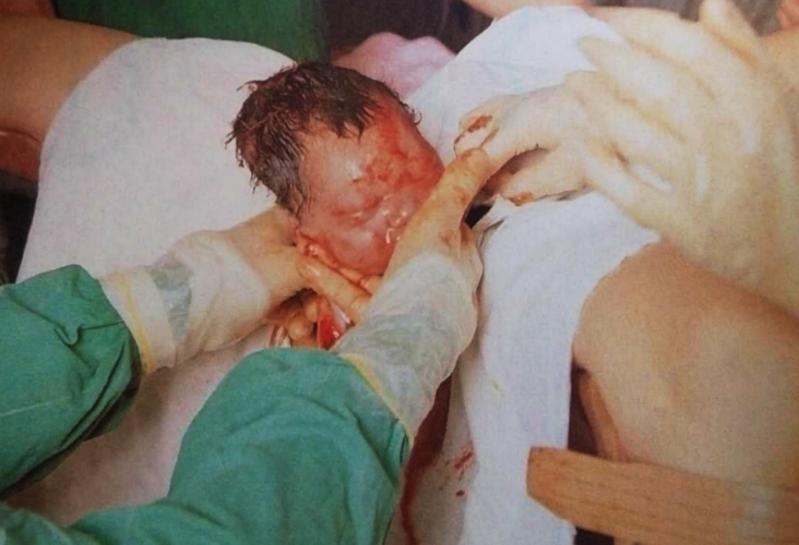 孕妇是怎么生孩子的