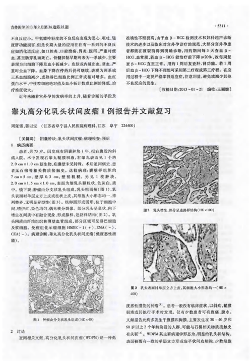 阴囊两侧灰色肉状东西