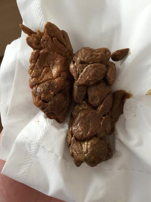 两三天不大便吃的东西哪去了