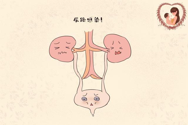 小孩子尿路感染怎么办