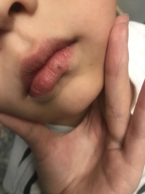 小孩子嘴唇发黑怎么回事
