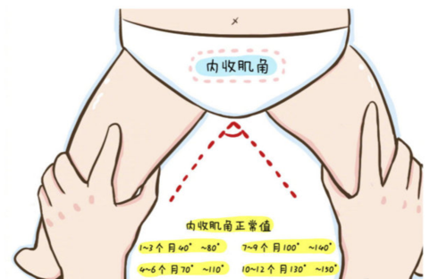 怎么判断孩子肌张力高