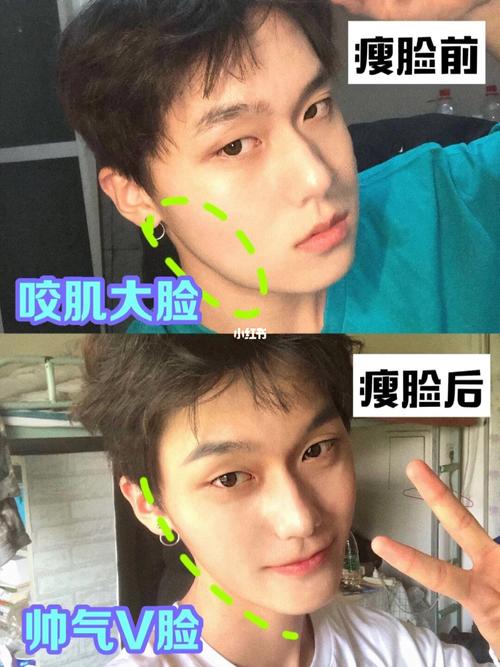 男人什么运动瘦脸