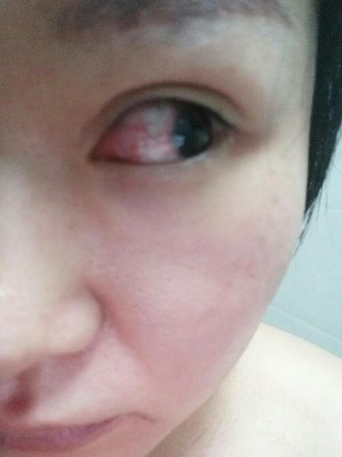 冲着东西了 眼睛红