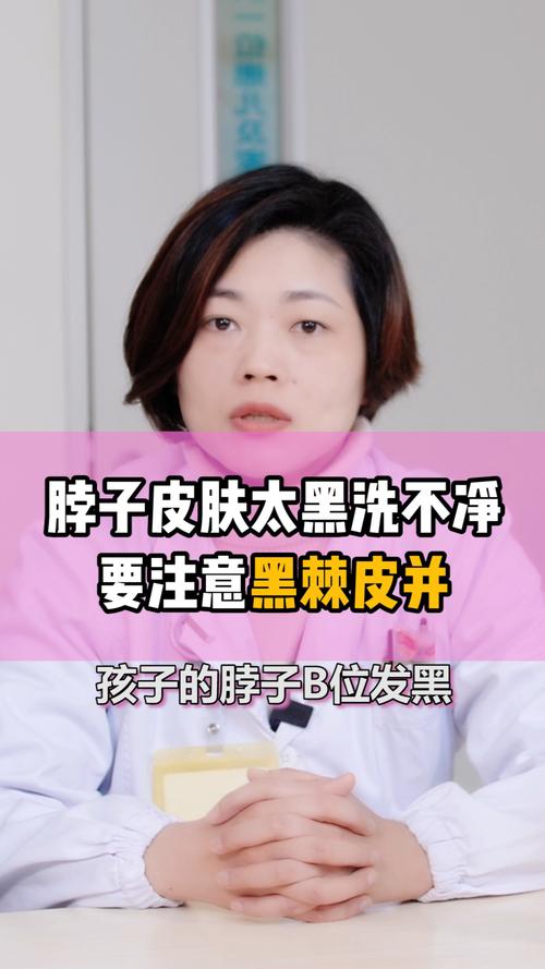 孩子黑怎么办