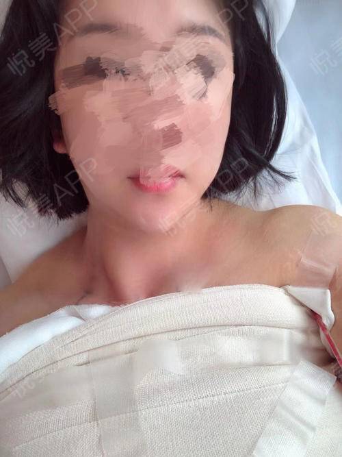 生完孩子没胸了怎么办