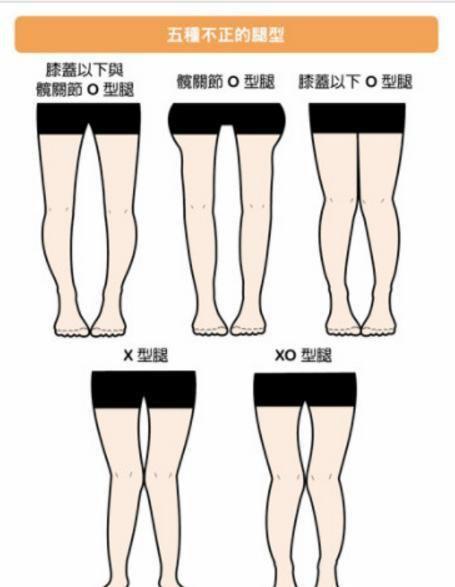 小腿外翻做什么运动