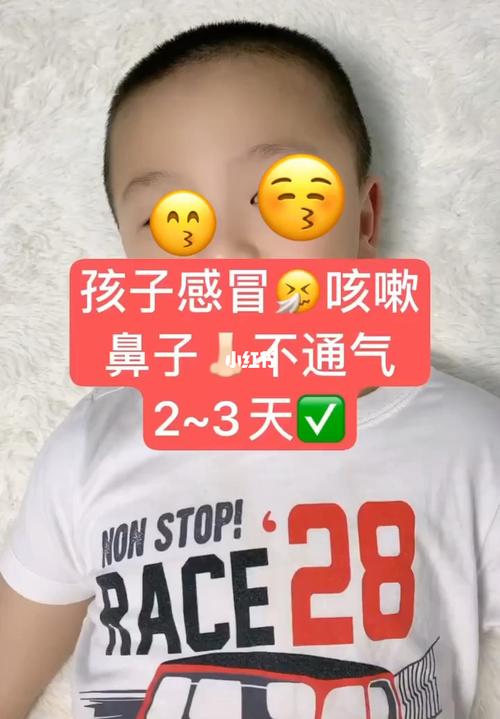 孩子上火鼻子不通气怎么办