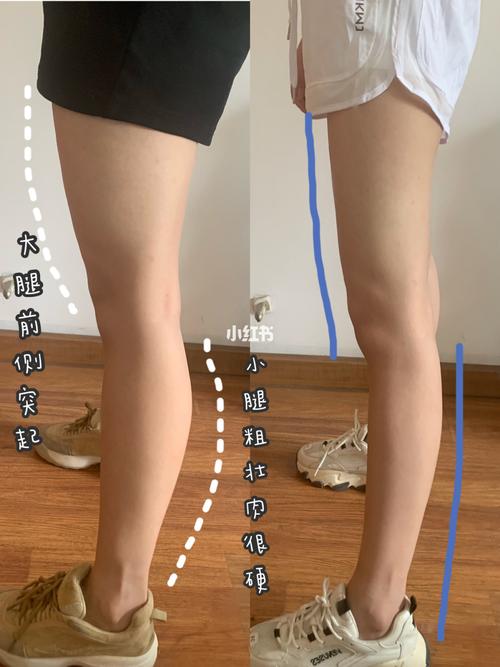 瘦腿运动3天出效果