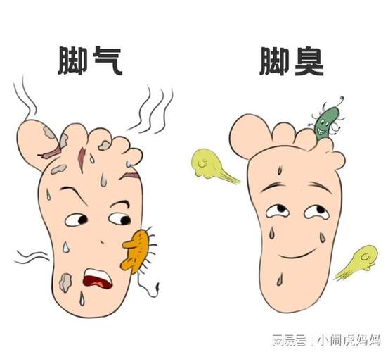 小孩子穿鞋脚臭怎么办