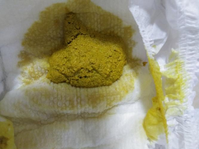 孩子拉粑粑干燥怎么办