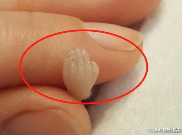 流产后的孩子怎么处理