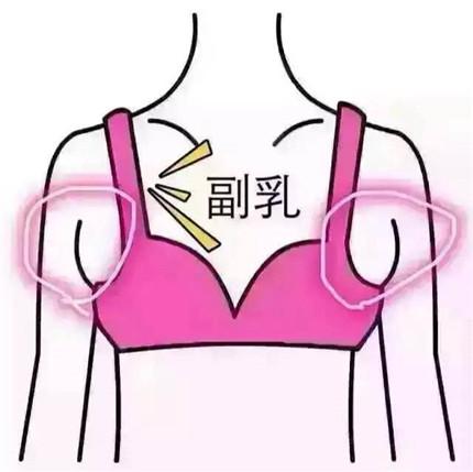 生完孩子副乳怎么消除